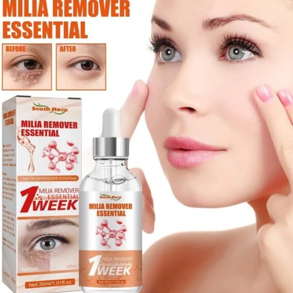 Milia Removal Essential, Milia Spot Treatment Helps Dissolve And Reduce Milia, Whitehead And Sebaceous Hyperplasia 30 ML