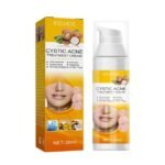 Intensive Acne Treatment Cream – Cystic Acne Repair, Moisturizing & Pore Shrinking Formula for Overall Clearer Complexion