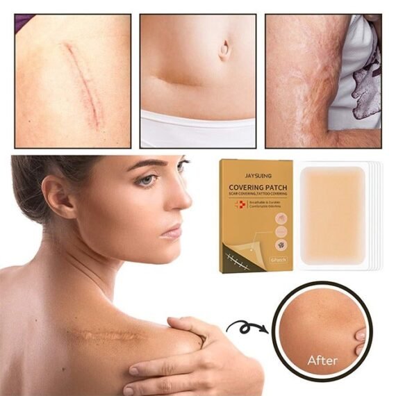 6 Patches Tattoo Cover Up Tape, Ultra Thin Skin Tone Concealer Sticker, Invisible Concealer Patch for Covering up Tattoos and Scars